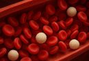 Anvisa aprova medicamento para leucemia mieloide aguda